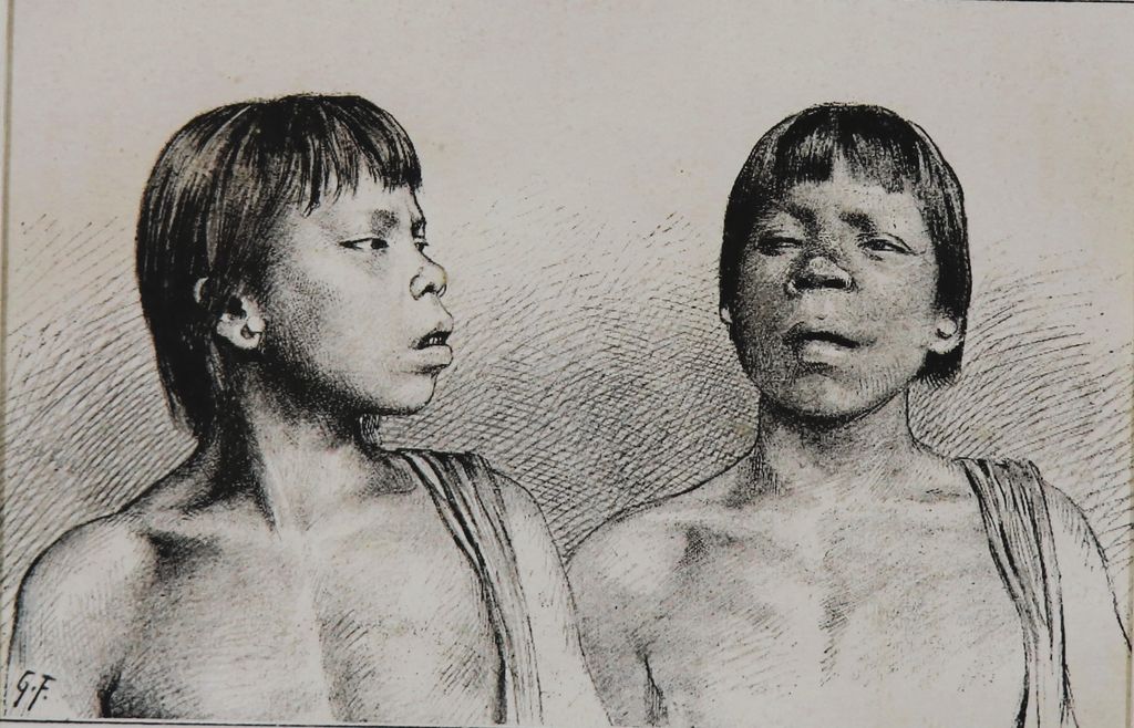 ຮູບ​ພ​າບຂາວດຳ ເຜົ່າຂະມຸຫຼວງພະບາງ ປີ 1894