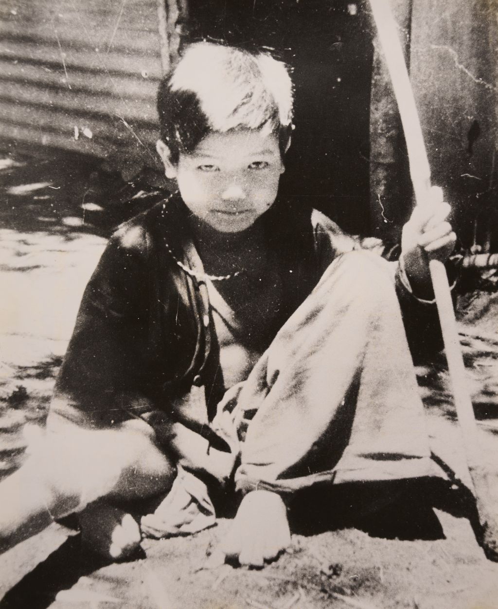 ເດັກ​ນ້ອຍ​ໄດ້​ຮັບ​ບາດ​ເຈັບ