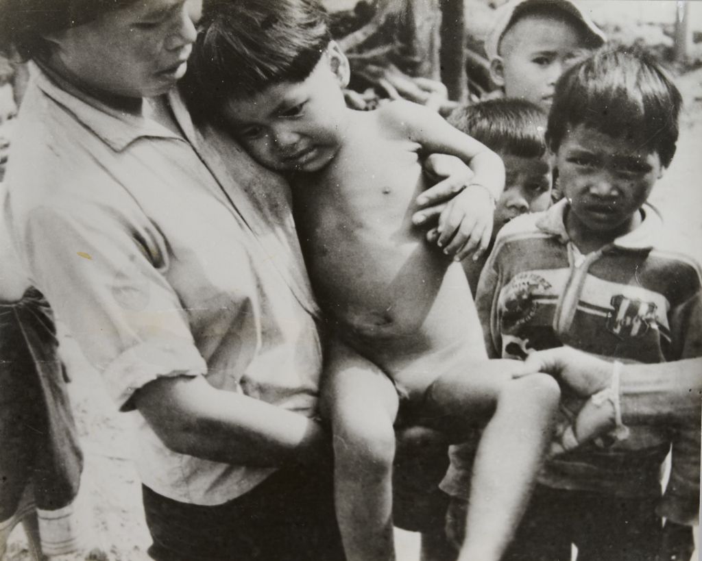 ເດັກນ້ອຍໄດ້ຮັບບາດເຈັບ