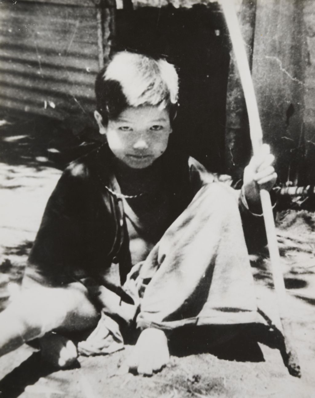 ເດັກ​ນ້ອຍ​ໄດ້​ຮັບ​ບາດ​ເຈບ