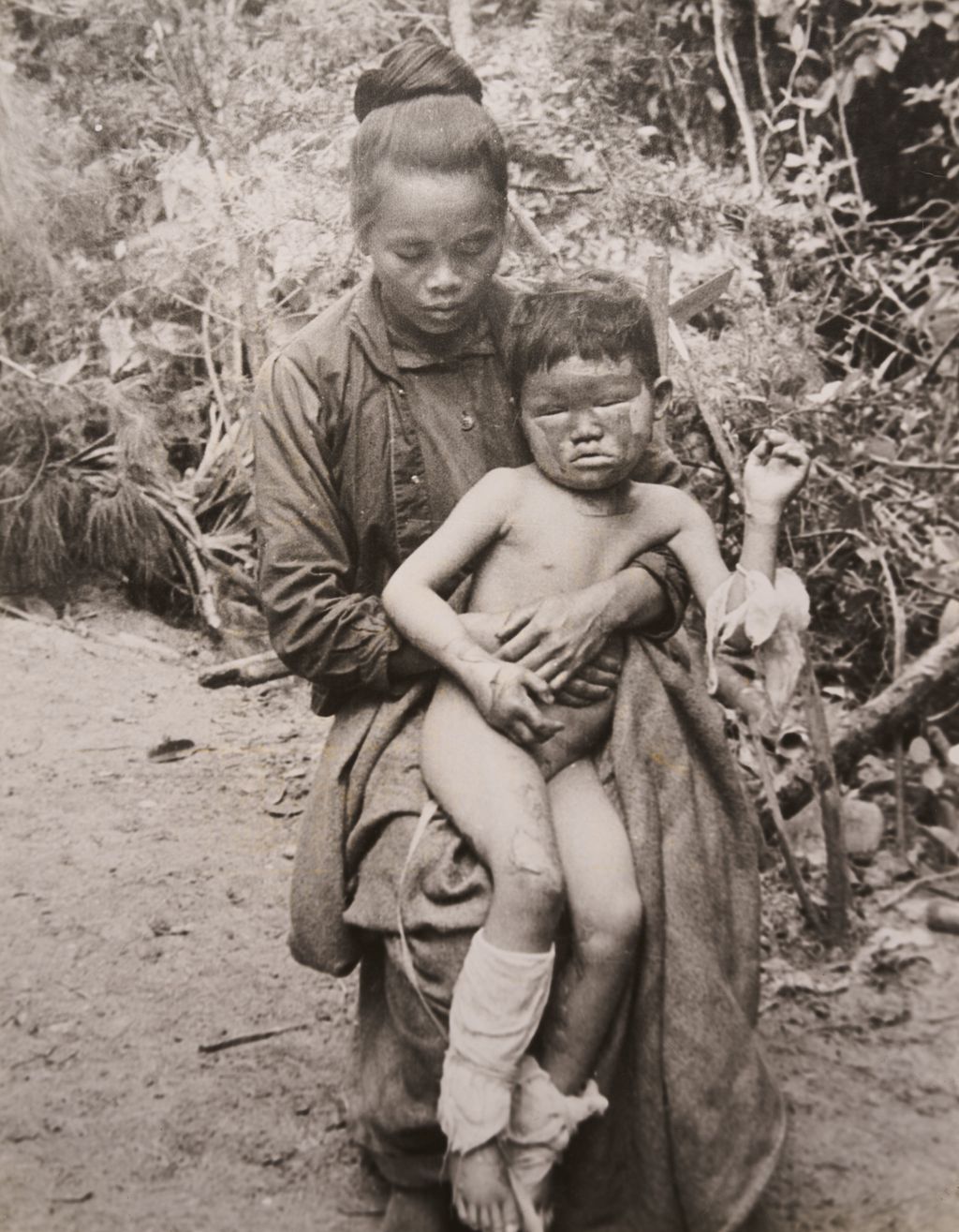 ແມ່​ອູ້ມ​ລູກ​ທີ່​ໄດ້​ຮັບ​ບາດ​ເຈັບ